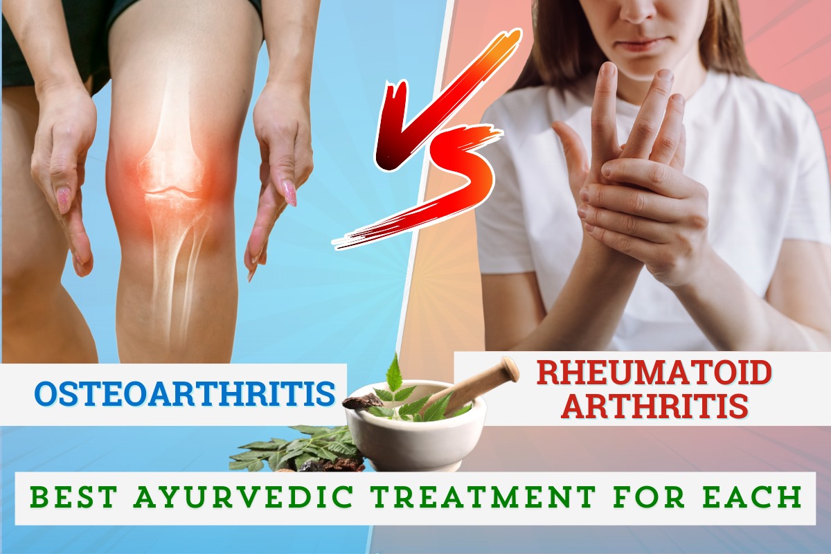 
                             Osteoarthritis vs. Rheumatoid Arthritis: Best Ayurvedic Treatment for Each
                             